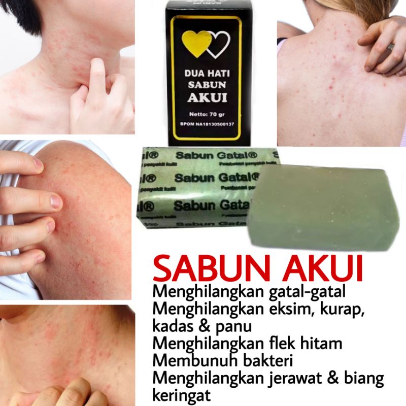 Sabun Akui BPOM/ Sabun Dua Hati / Sabun Gatal / Sabun Sulfur / Sabun Belerang / Sabun Eksim / Sabun Kurap / Sabun Kadas / Sabun Panu / Sabun Menghilangkan Flek / Sabun Menghilangkan Jerawat / Sabun Anti Gatal / Sabun Sulfur Untuk Gatal / Sabun Atasi Gatal