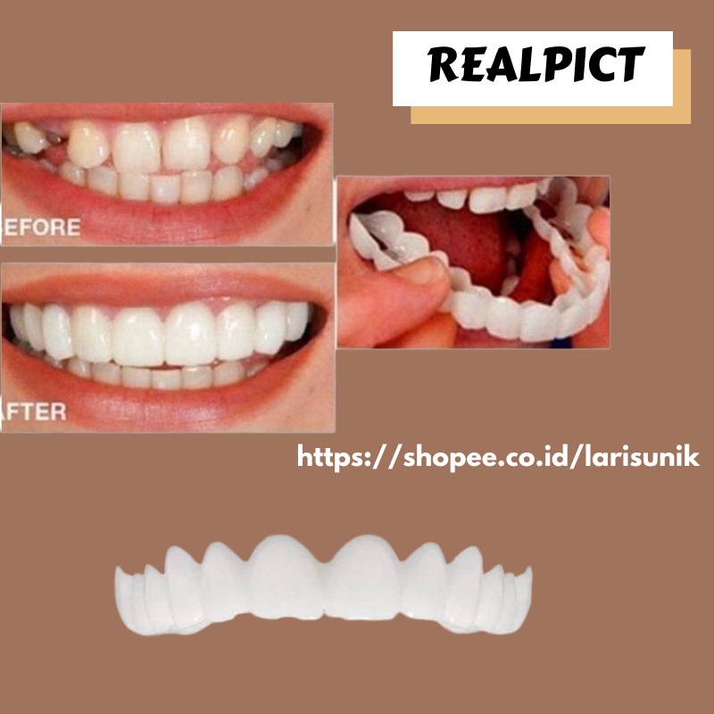 Gigi Palsu Silikon Alami  Gigi Palsu Atas Bawah Instan