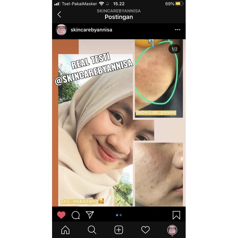 

oshinbeauty/skincareaman/skincarebpom/skincarepemutih