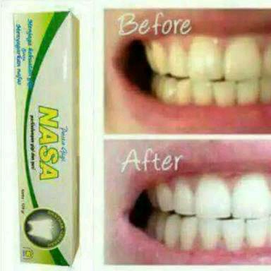 PASTA GIGI NASA ORIGINAL - PRODUK TERLARIS NASA