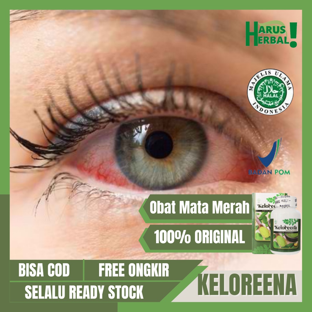 Obat Sakit Mata, Obat Mata Merah, Obat Mata Iritasi, Obat Konjungtivitis, Obat Mata Gatal, Obat Mata