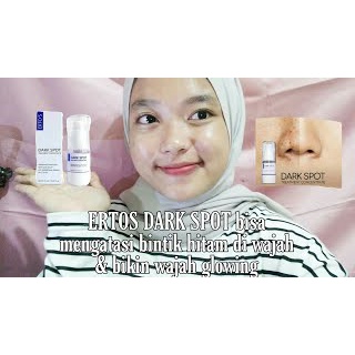 [ORI] Serum Pencerah Wajah Ampuh Menghilangkan Flek Dark Spot Treatment Concentrate dalam 2 Minggu