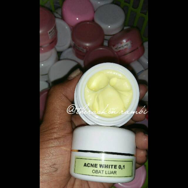 

Acne white 0,1