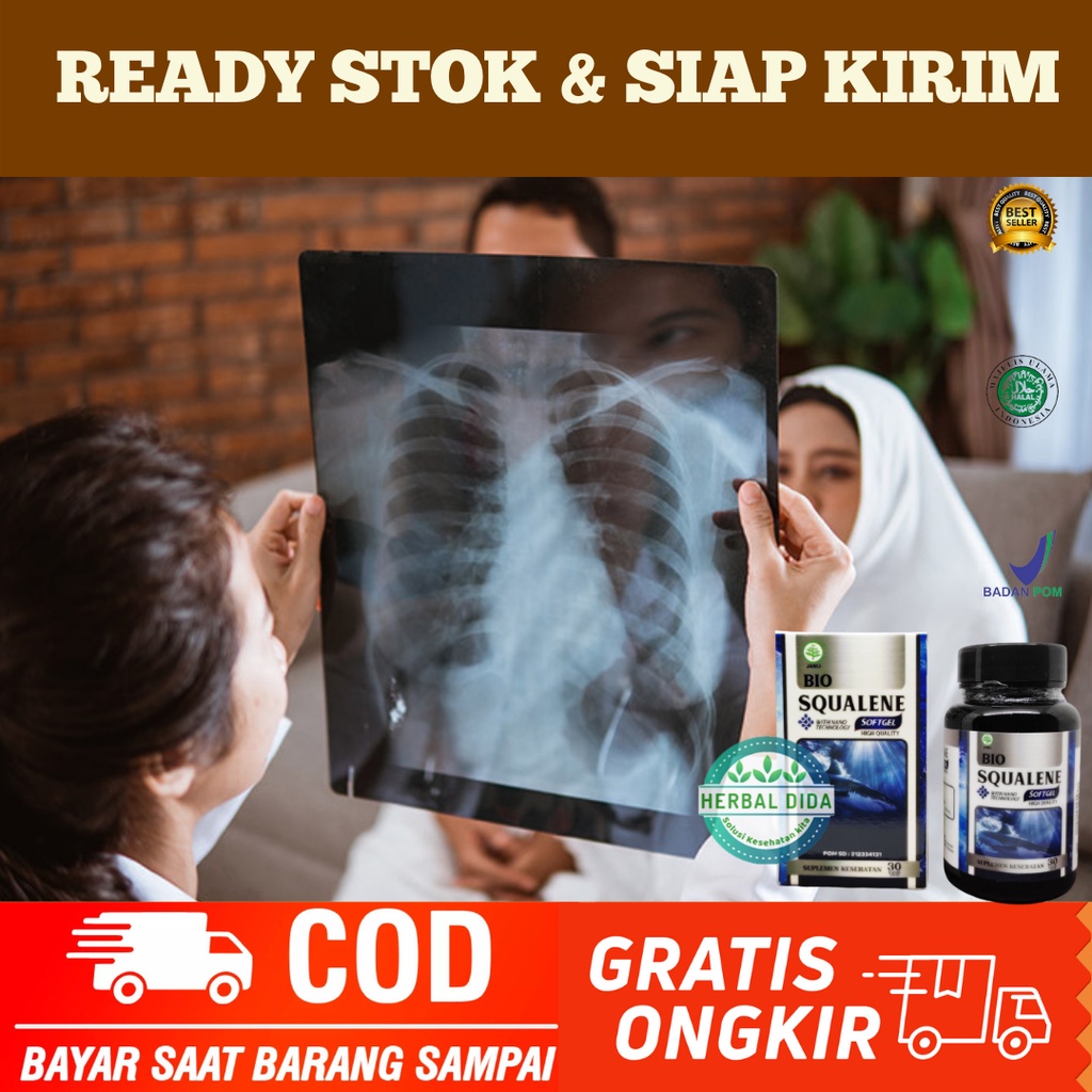BIO SQUALENE 100% ORIGINAL BPOM, Obat Herbal Bronkitis, Obat Herbal Mengatasi Bronkitis, Obat Herbal