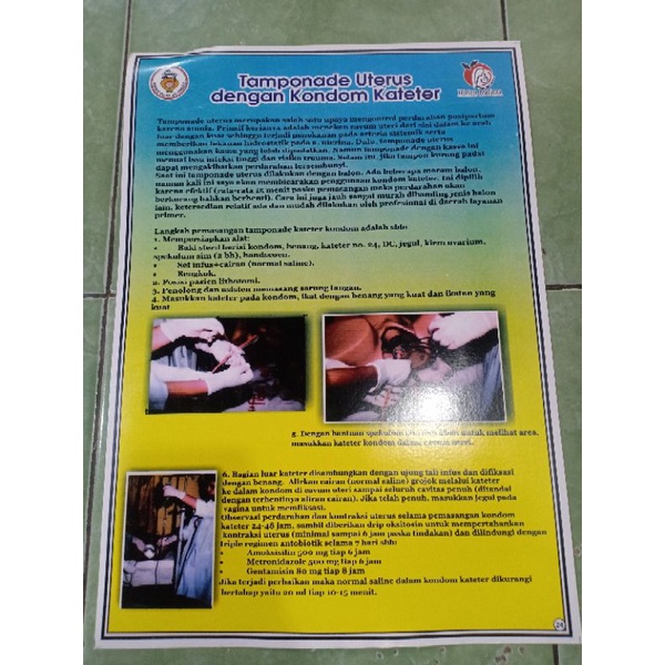 (24) POSTER TEMPONADE UTERUS DGN KONDOM KATETER