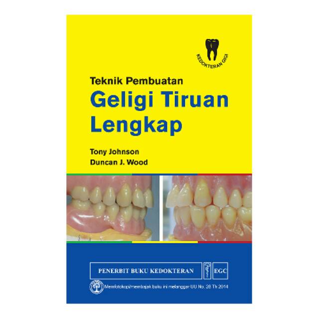 Teknik Pembuatan Geligi Tiruan Lengkap