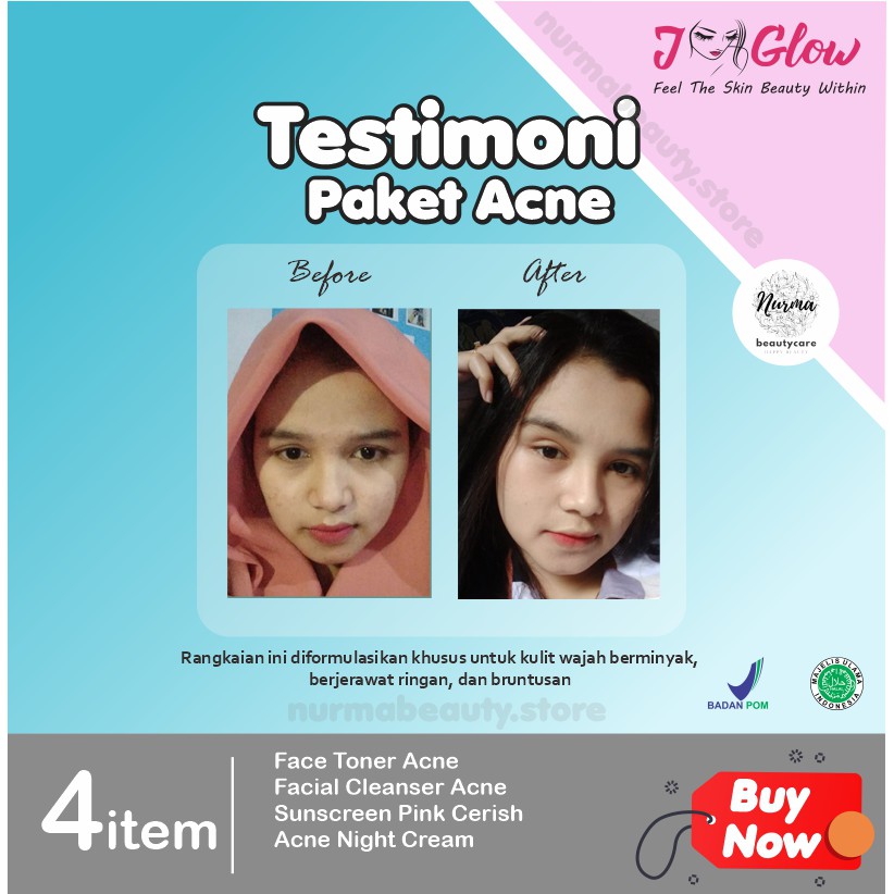 Jglow J glow Skincare Acne Krim Jerawat Perawatan Kecantikan Pemutih Wajah Glow Glowing BPOM Aman-6