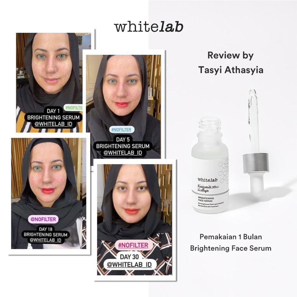 Whitelab Brightening Face Serum - Niacinamide 10%