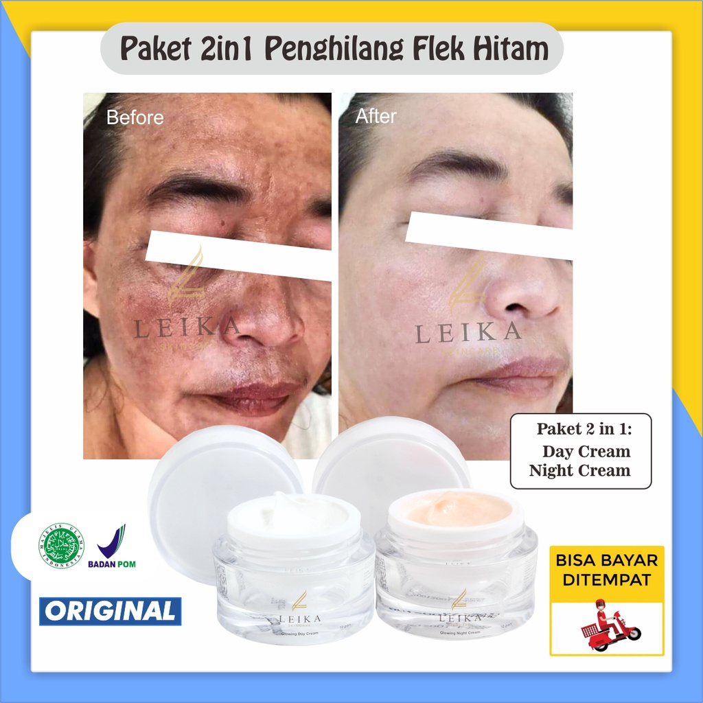 Paket 2in1 Cream Siang Dan Cream Malam Penghilang Flek Hitam Ampuh Menghilangkan Flek Hitam Membande