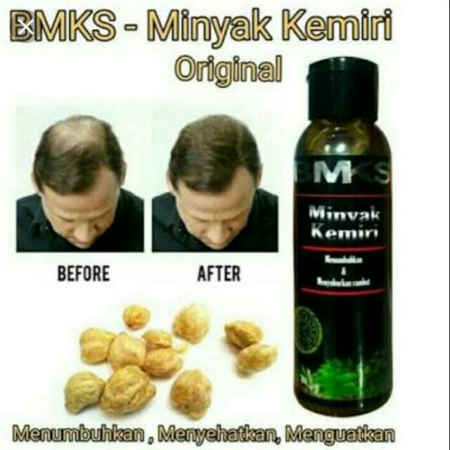 BMKS MINYAK KEMIRI ORIGINAL BPOM  MENUMBUHKAN &amp; MENYUBURKAN RAMBUT