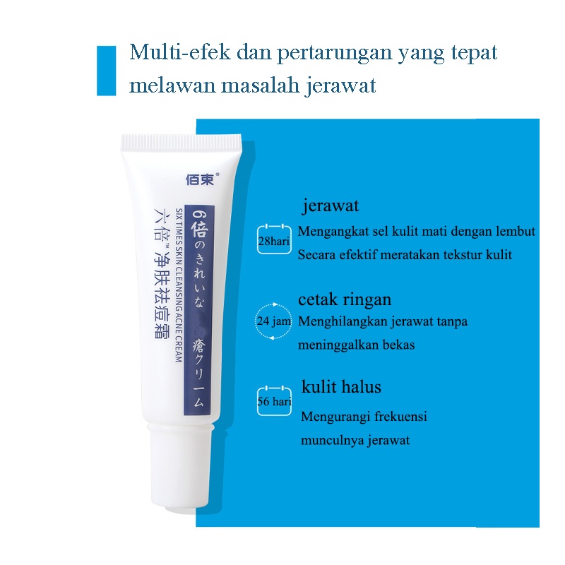 Krim Penghilang jerawat Ampuh 30g AMPUH Penghilang jerawat  permanen untuk wajah berjerawat dan bekas jerawat 6x Krim Jerawat Perbaikan Lemak Hiu Penghilang Jerawat Paling Ampuh Menghilangkan Jerawat dan Bekas Jerawat