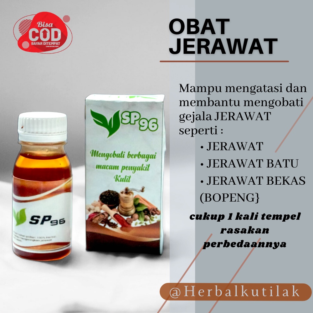 OBAT Jerawat Batu Acnes gel SP96 Pria dan Wanita Obat Bekas Jerawat Menahun, Obat Flek Jerawat, peng