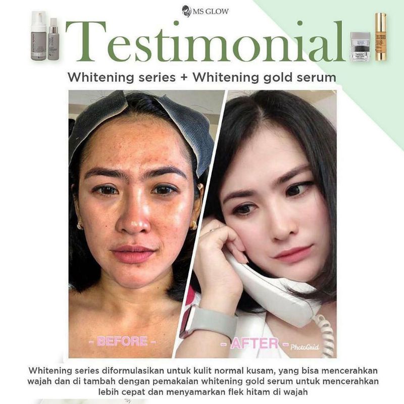 MS GLOW Paket Free Bonus Pouch/Dompet Kosmetik/Ecer Whitening Night Cream/Luminous/Malam Ultimate/Krim Siang/Facial Wash Msglow/Toner Acne/Glowing/Sabun Men/Day/Man Basic/Serum Gold/Peeling/JJ Glow/DTE/Underarm/Red Jelly/Radiance Gel/Scrub Original Asli