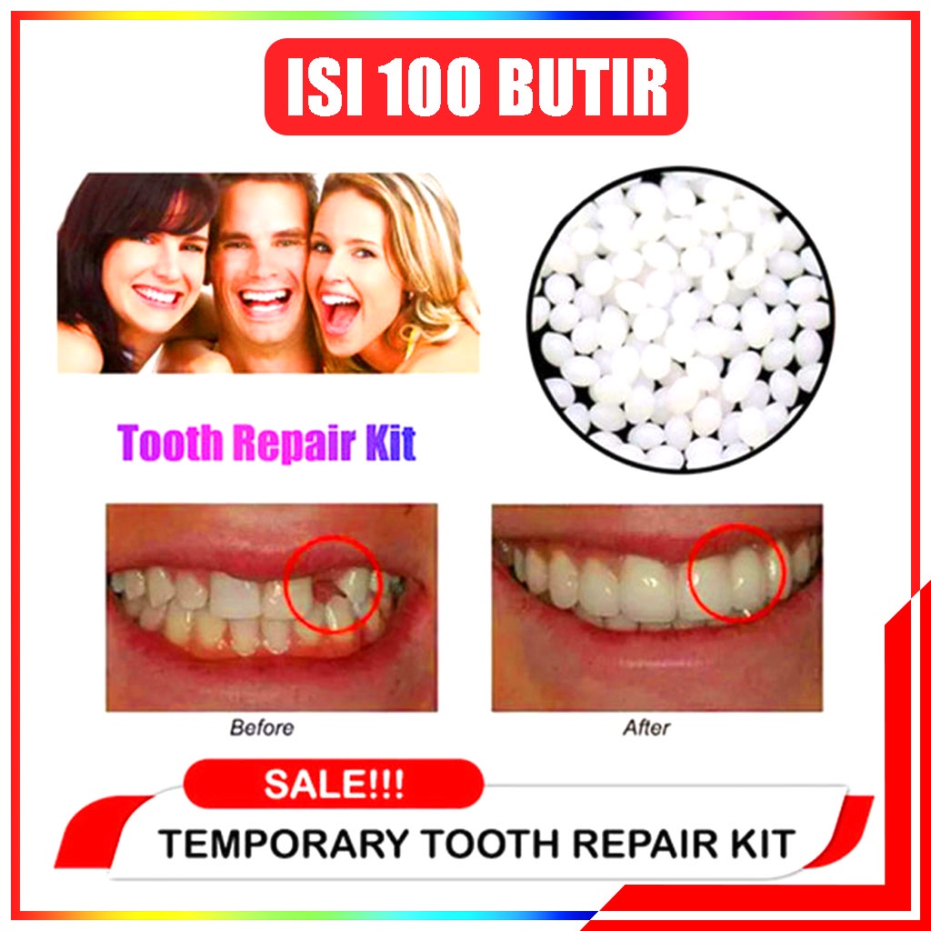 Gigi Palsu / Penambal Gigi Temptooth Toothtemporary Isi 100 Butir