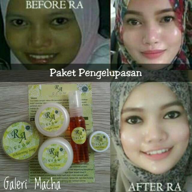 RA GLOW (PAKET PENGELUPASAN) CREAM PEMUTIH WAJAH