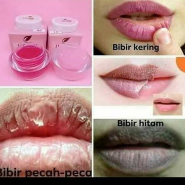 Anti Bibir Hitam Lip Care Sr12