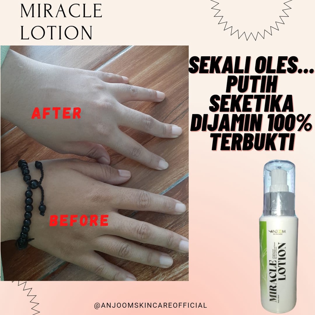 MIRACLE LOTION ANJOOM SKINCARE