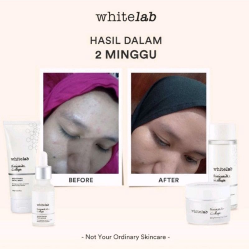 Whitelab Brightening Paket Wajah & Serum 100% ORI dan TERLARIS !!!-7