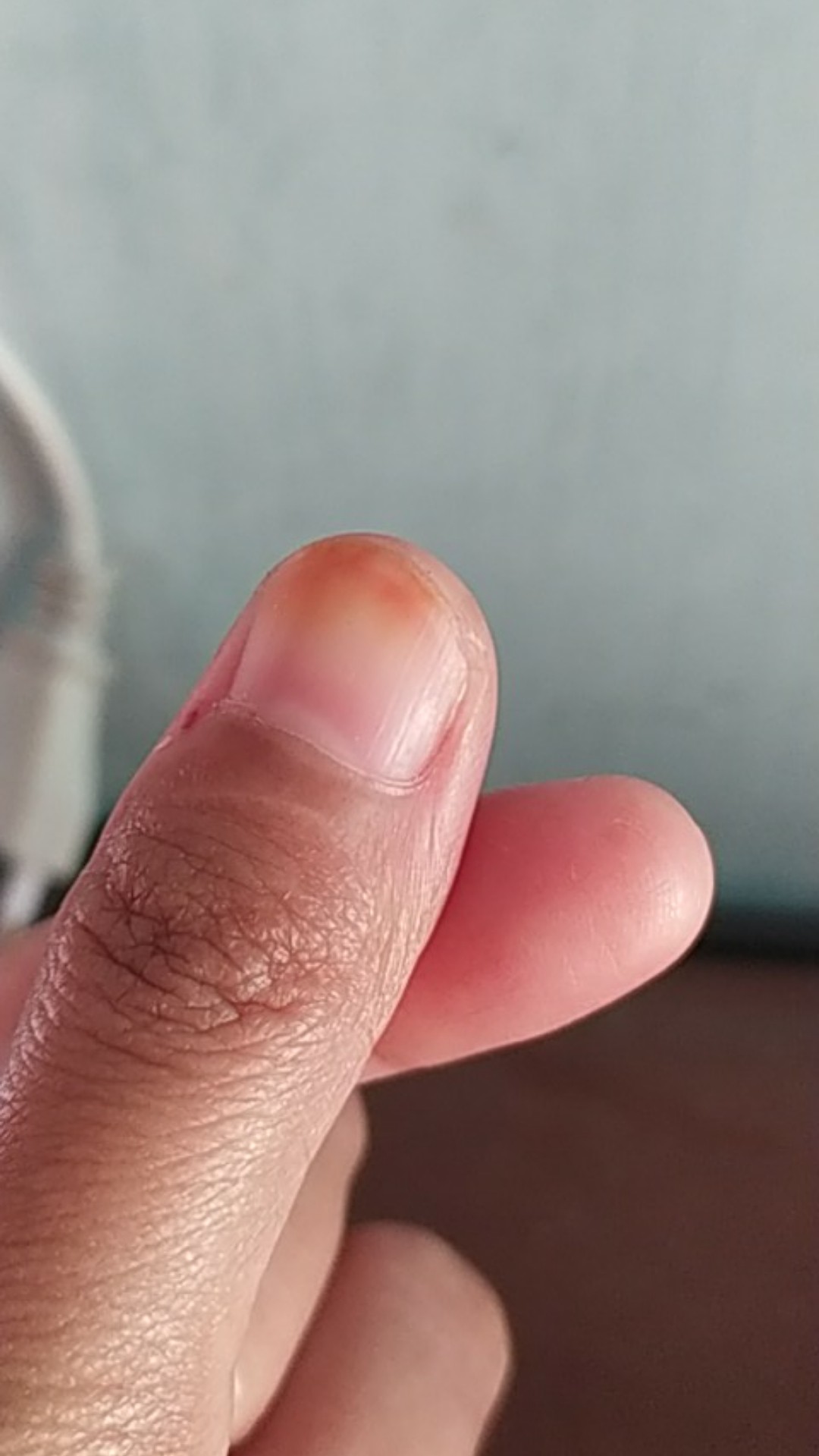 Shaft Stainless 10mm Per Cm Aisi Sus 304 Smooth Rod Linear Rail