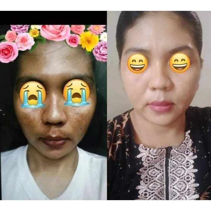 Ratu Glow Skincare BPOM Viral PAKET CREAM WAJAH Glowing series Paket Normal Flek Jerawat bopeng |skincare pelicin wajah-7
