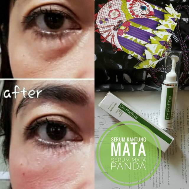Terlaris original SERUM MATA - DR REFINA VIGOROUS ACTIVE EYE COUNTOUR BPOM resmi 100%