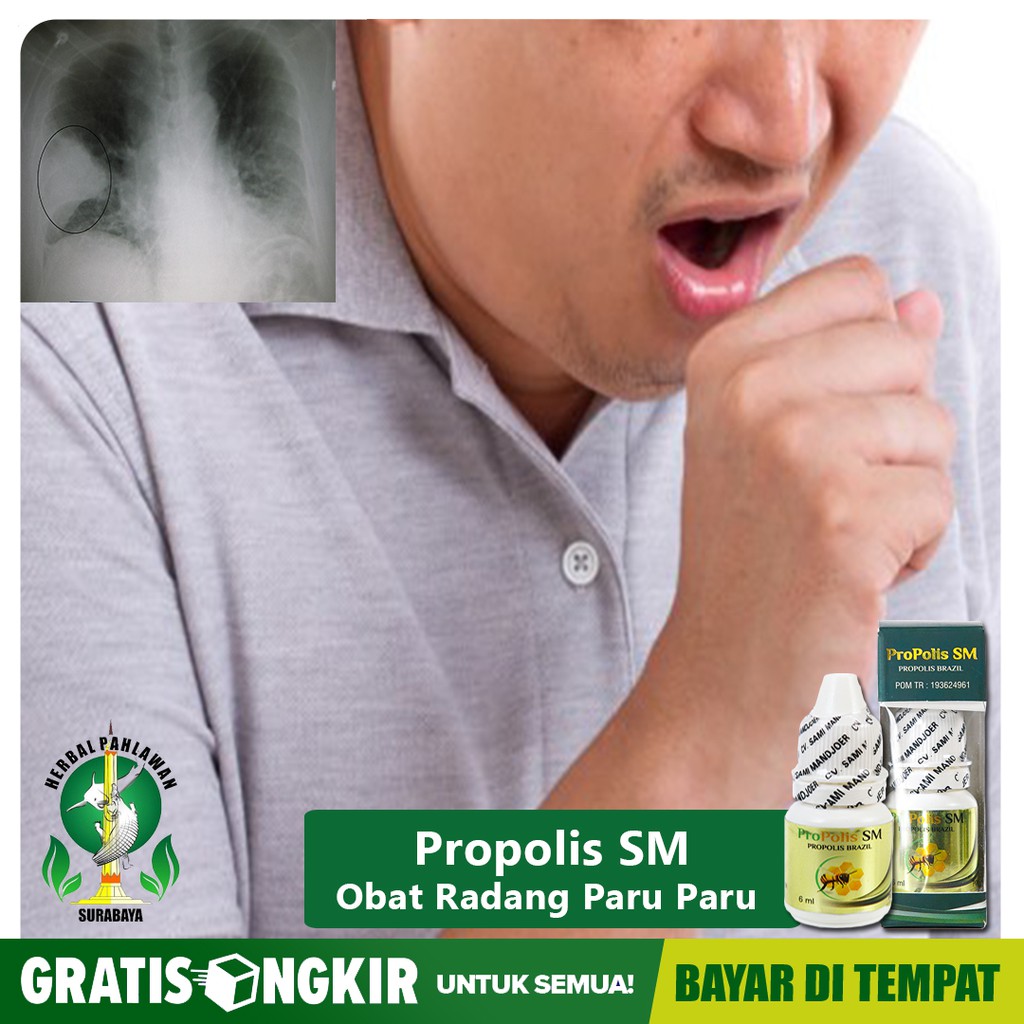 

Propolis SM Obat Herbal Sesak Nafas - Detox - Radang Paru Batuk Ringan - TBC