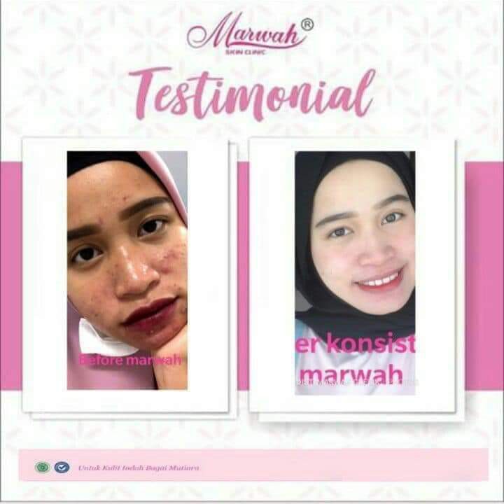 Derma Acne/Cream marwah paket derma acne Murah