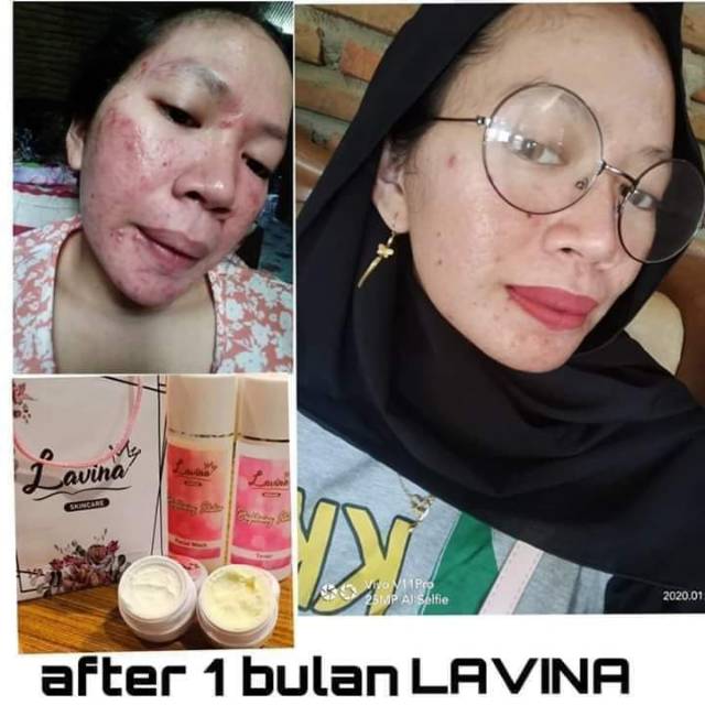 Lavina skincare