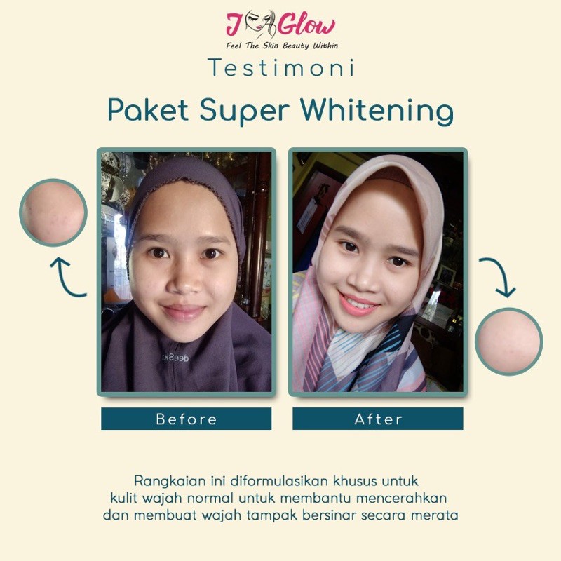 JGLOW SUPER RADIANCE WHITENING ORIGINAL