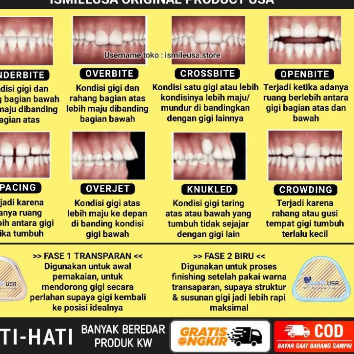 Sale Ismileusa Ismile Usa Perapih Gigi Behel Gigi Perata Gigi Teeth Trainer Original Re Shopee Indonesia