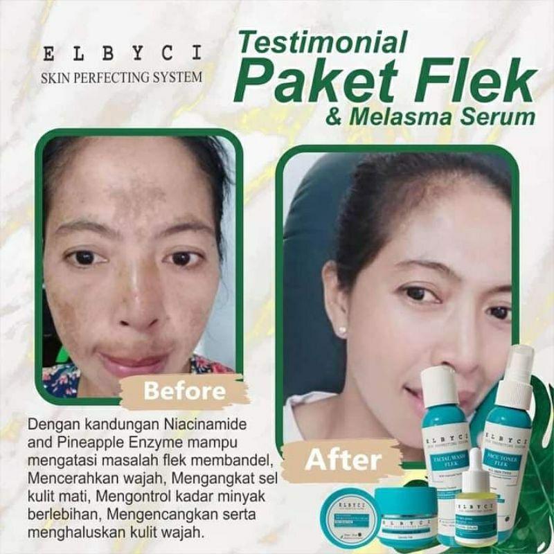 ELBYCI PAKET FLEK