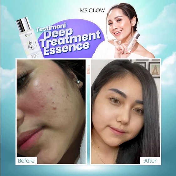 Ms glow Deep TREATMENT ESSENCE ORIGINAL