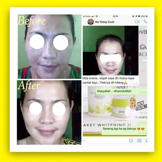 PAKET MULUS JERAWAT EVANA BEAUTY CARE BPOM
