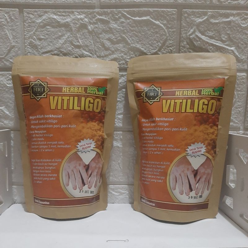 vitiligo herbal OBAT VITILIGO HERBAL ASLI MURNI ALAMI