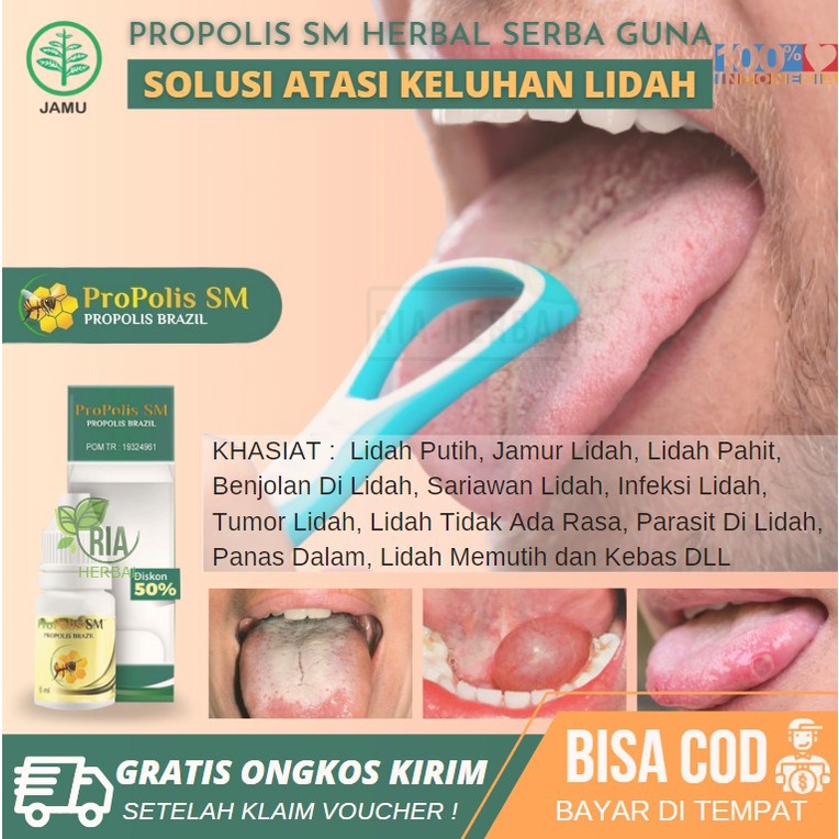 Obat Penghilang Bau Mulut Herbal Alami, Kronis, Menahun, Tidak Sedap, Kumur Bau Mulut, Mulut Cepat B