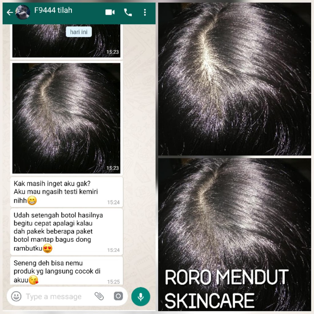 Roro Mendut Saripati Kemiri Penumbuh Penebal Rambut Bayi Dewasa Rontok Botak Jambang Brewok Kumis