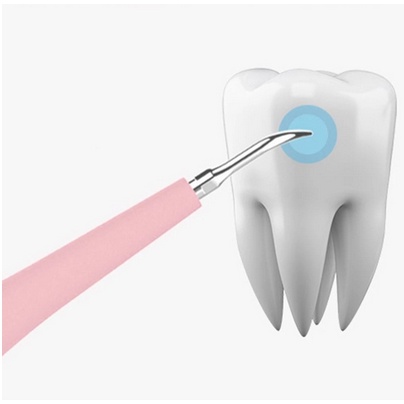 TOOL DENTAL SCALER PORTABLE ALAT PEMBERSIH PLAK GIGI / Alat Pembersih Karang Gigi Penghilang Plak Elektrik