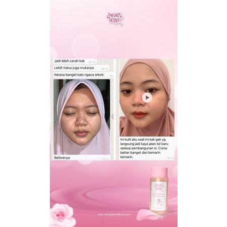 Toner Ohmyskin (Free Gift) Deep Brightening Rose Infuse Toner