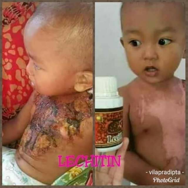 

Sari kedelai lecithin