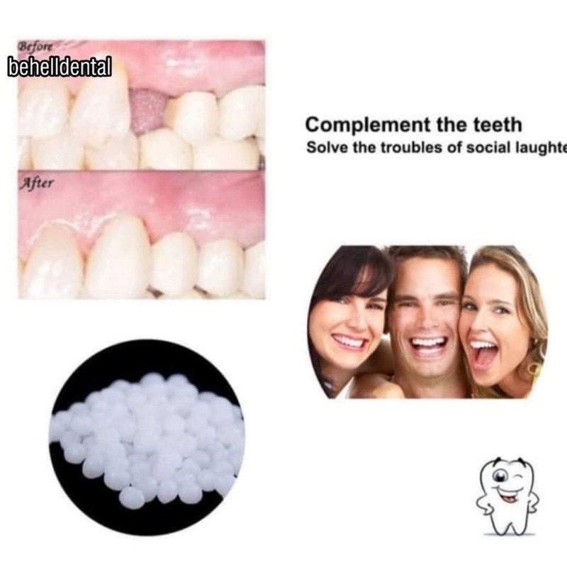 TERMURAH !! 500 BUTIR TEMPTOOTH GIGI PALSU SEMENTARA PENAMBAL GIGI PATAH RENGGANG / TEMTOOTH / BAHAN TAMBAL GIGI BOLONG BERLUBANG / TEMPORARY TOOTH INSTAN PRAKTIS / TEMPTOOTH GINGSUL PATAH LEM TIRUAN MURAH ORIGINAL ISI 200 / 500 / 400 / 150 / 100 BUTIRi