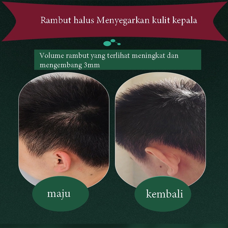 shampo anti ketombe 200g  gatal Shampo Perawatan Kulit Kepala Efektif memelihara kulit dan menumbuhkan rambut bergizi