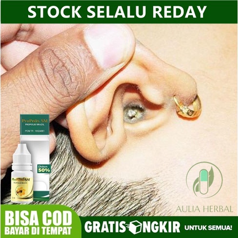 Obat Penghancur Kotoran Telinga Keras, Kotoran Telinga kering Menumpuk, Obat Tetes Telinga