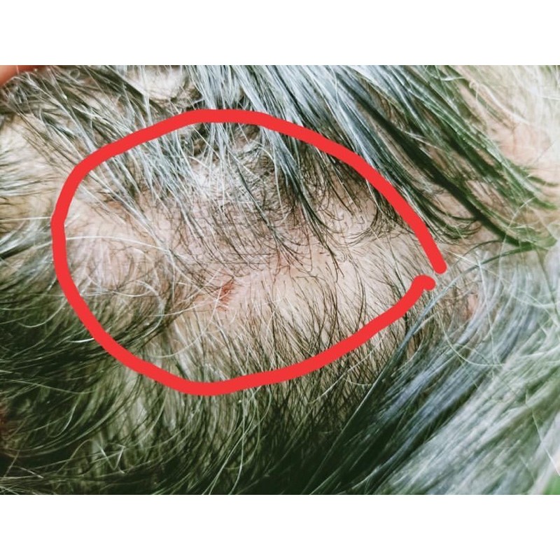 follow me green tea shampoo conditioner 100ml  |  followme greentea sampo manise rontok anti hairfall-3