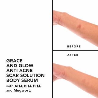 ✨ AKU MURAH ✨ Grace and Glow English Pear and Freesia Anti Acne Hand and Body Lotion / Body Serum