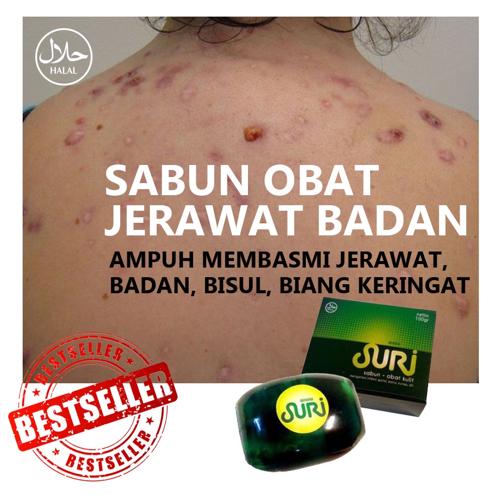 Sabun Suri - Penghilang Jerawat Biang Keringat Badan Punggung