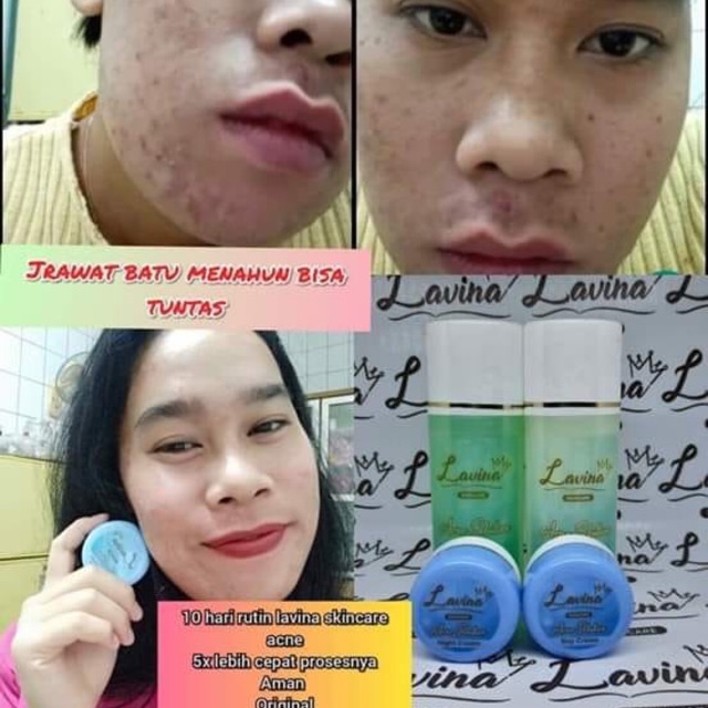 Lavina skincare