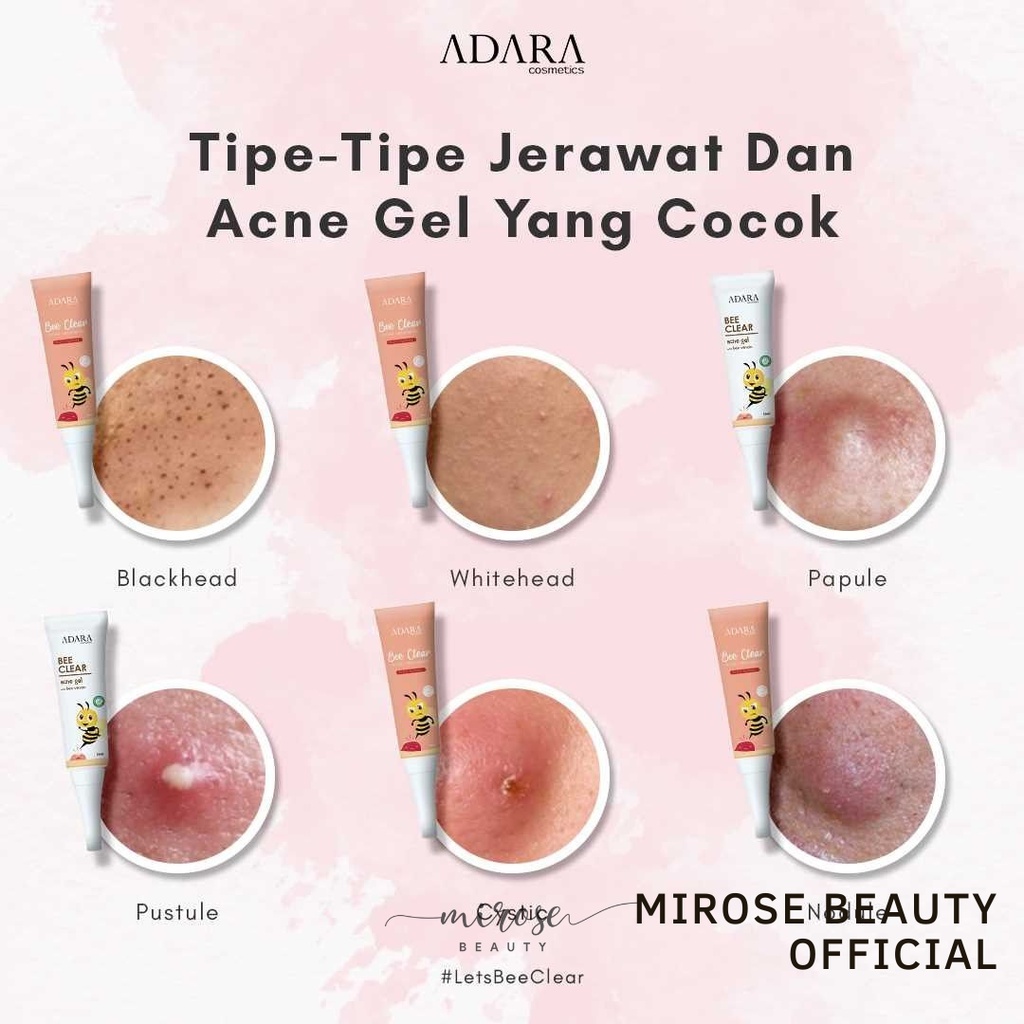 ADARA BEE CLEAR ACNE GEL