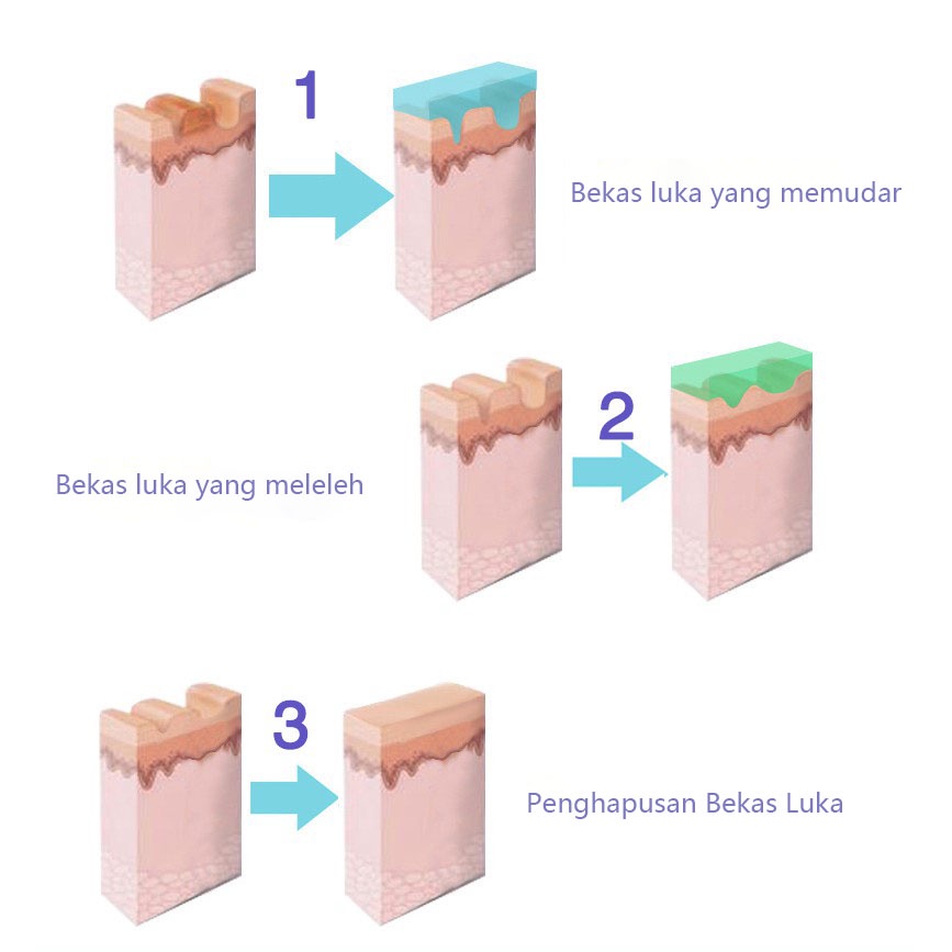 Krim penghilang bekas penghilang bekas luka penghilang bekas jerawat 60g Menghilangkan bekas luka dengan cepat dan lembut stretch mark bekas jerawat mengembalikan kulit halus