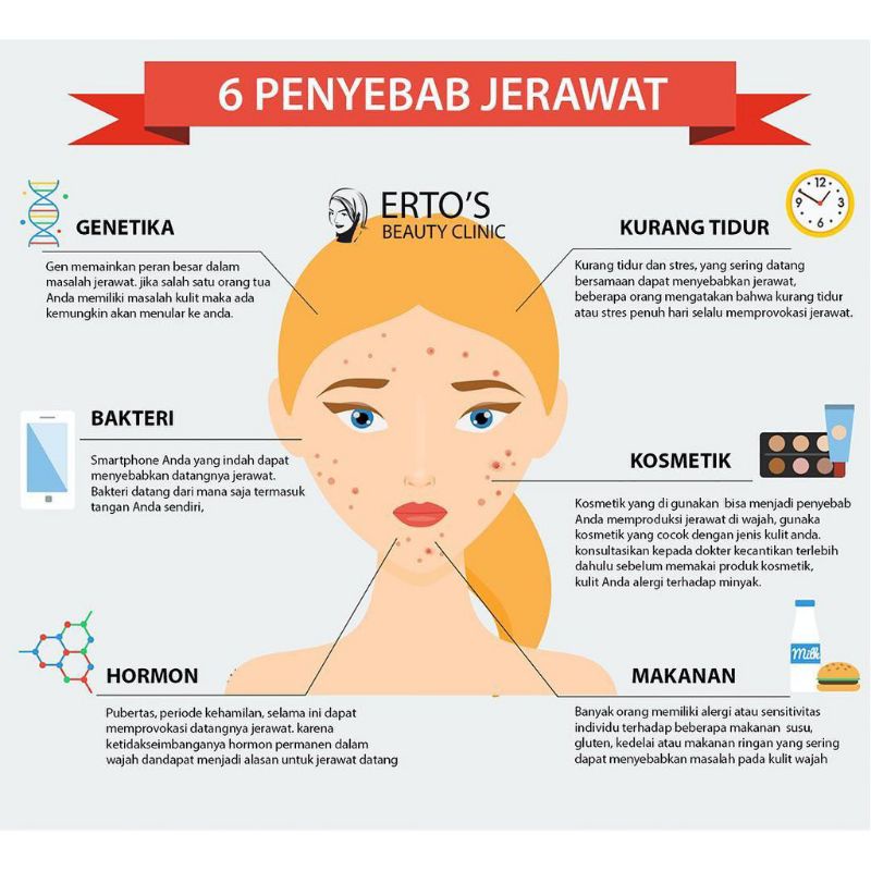 Ertos Masker Anti Jerawat Paling Ampuh Anti Acne Mask ERTO'S Skincare Original BPOM