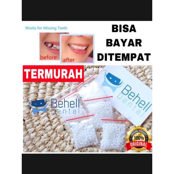 temptooth penambal gigi berlubang original